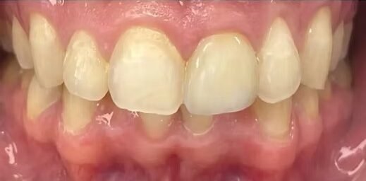 smile-makeover-before-after-5 (2)