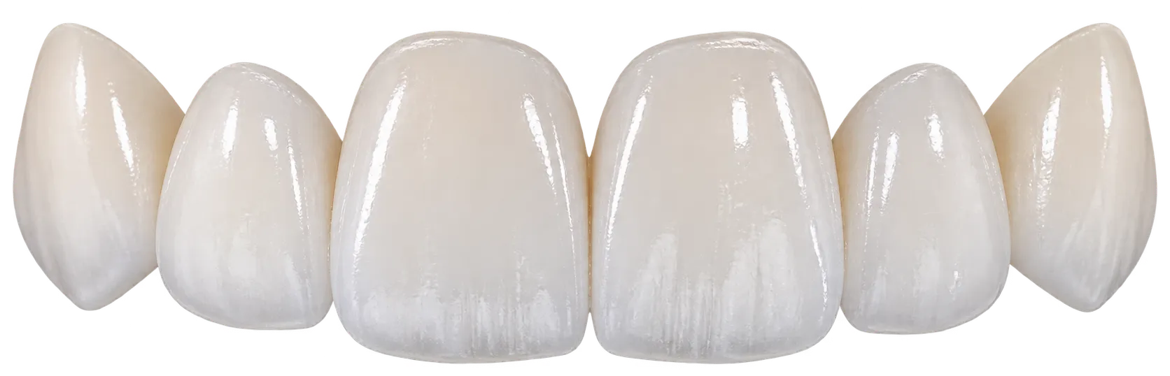 Porcelain Veneers
